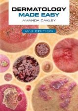 Dermatology Made Easy second edition