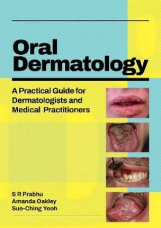 Oral Dermatology by S.R. Prabhu & Amanda Oakley & Sue-Ching Yeoh