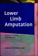 Lower Limb Amputation A Guide To Living A Quality Life